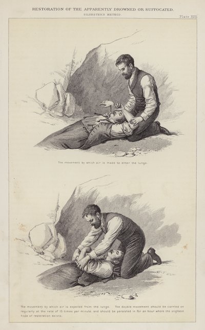Restoration of the Apparently Drowned or Suffocated by English School