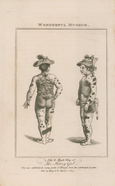 Side and Back View of the Hairy Girl by English School