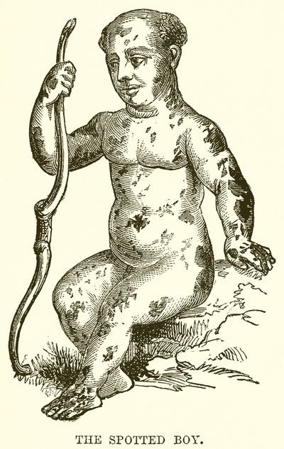 The Spotted Boy by English School