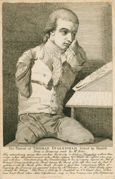Thomas Inglefield, Born 18 December 1769 at Hook, Hampshire, Without Arms or Legs by English School