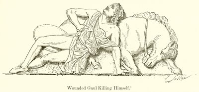 Wounded Gaul Killing Himself by English School