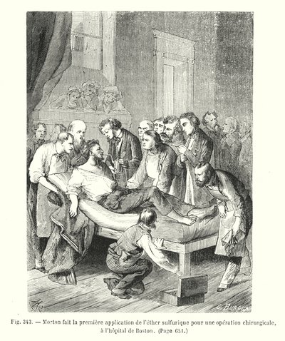 Morton makes the first application of sulfuric ether for a surgical operation, at the Boston hospital by European School