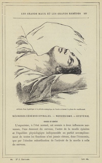 Attitude of a Hysterical Person in the Cataleptic Stage of the Attack and During the Crucifixion Phase by French School