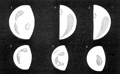 Dark spots and bright spots of Venus; 1, 2, 3, spots observed by D. Cassini in 1667 and 1667; 4, 5, 6, spots observed by M. Langdon in 1871 by French School