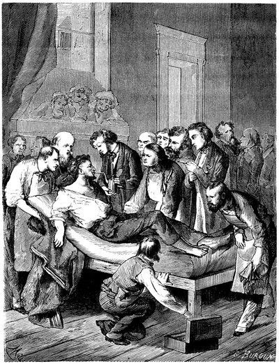 First surgical operation with sulfuric ether anesthesia at Boston Hospital, performed on October 16 by French School