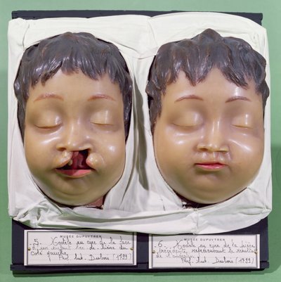 Model showing a child