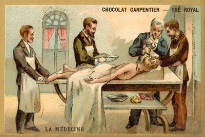 Trepanning by French School