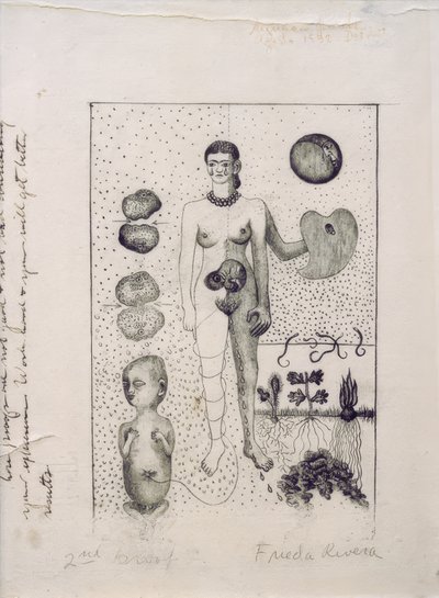 Frida and the Miscarriage by Frida Kahlo