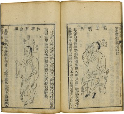 Shen Shi Yao Han: A Precious Book of Ophthalmology, 1644 by Fu Renyu