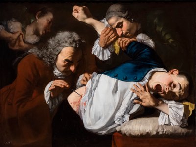 The Operation, circa 1753/54 by Gaspare Traversi