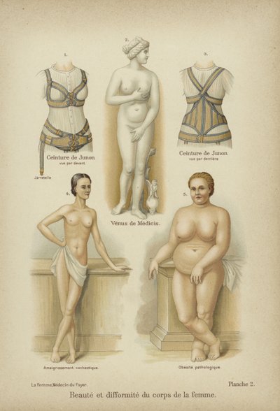 Beauty and Misshapenness in the Female Body by German School