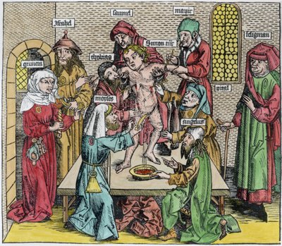 Circumcision, from 