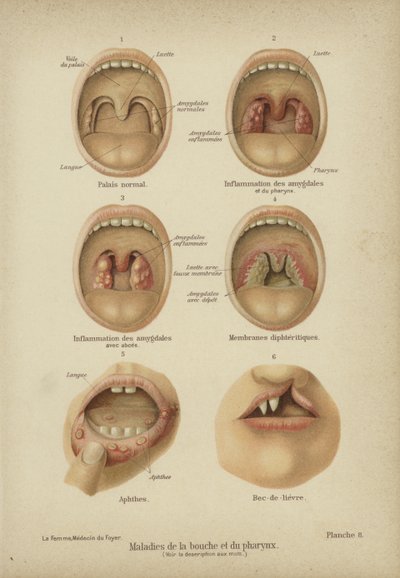 Diseases and Disorders of the Mouth and Throat by German School