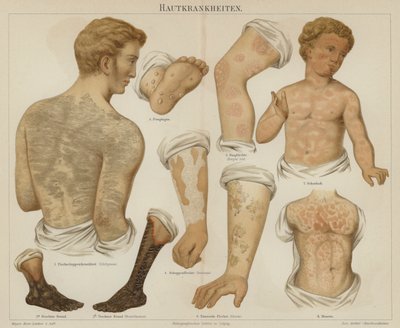 Skin disorders by German School
