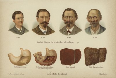 The effects of alcohol abuse by German School