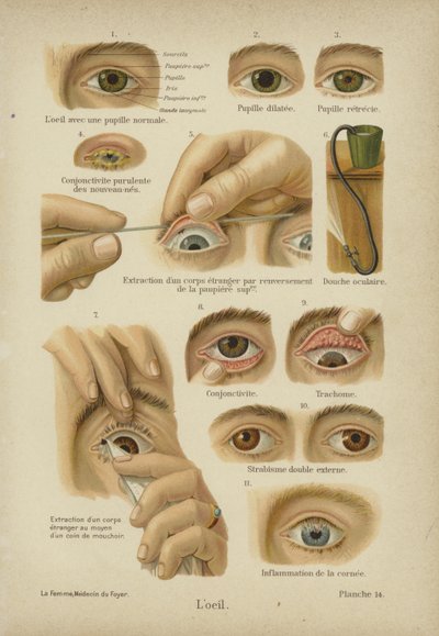 The Eye by German School