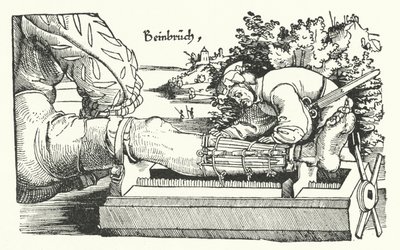 Treating a Fractured Leg by German School