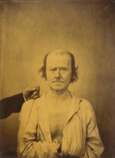 Attention (left); Reflection (right) by Guillaume-Benjamin-Armand Duchenne de Boulogne