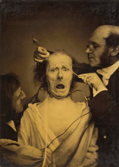 Terror Mixed with Pain, Torture by Guillaume Benjamin Amant Duchenne