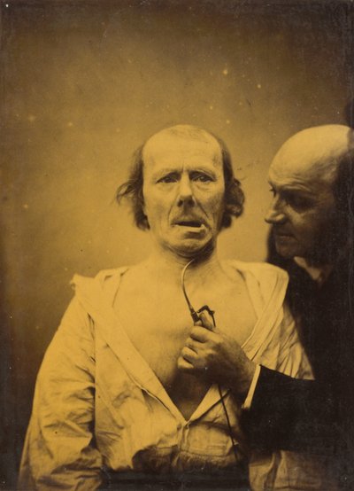 This contraction of m. platysma alone lacks expression by Guillaume Benjamin Amant Duchenne