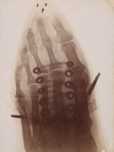 The Foot Through the Shoe by Henri van Heurck