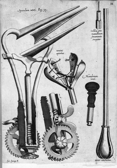 Gynecology: Plate Representing a Speculum. Engraving by Girolamo Fabricii in 