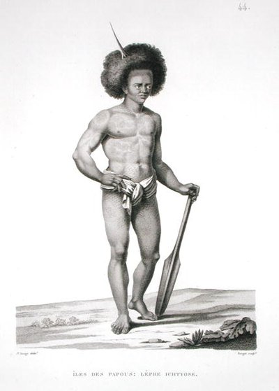 Papua Islands: Leprosy Victim, from 