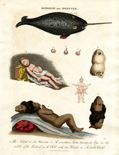 Narwhal and Malformations by John Pass