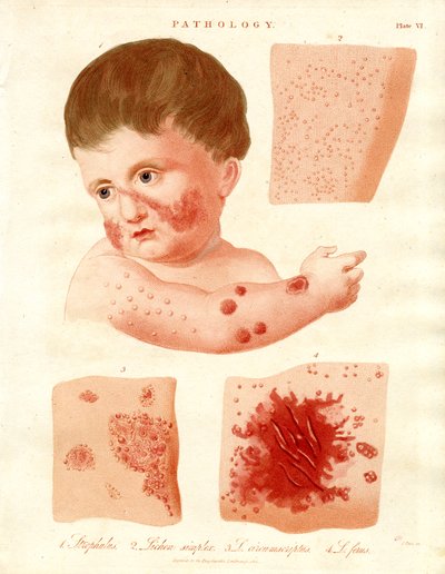 Pathological Skin Diseases by John Pass