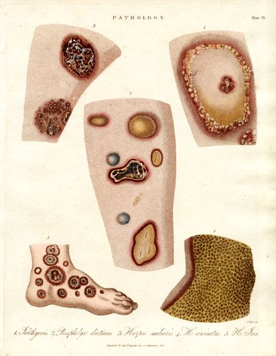 Various Skin Eruptions and Ulcers by John Pass