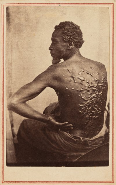 The Scourged Back, c. 1863 by McPherson & Oliver