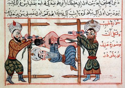 Reduction of a fracture by Ottoman School