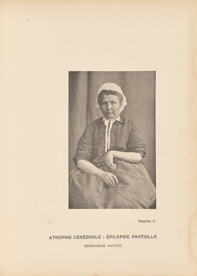 Cerebral Atrophy: Partial Epilepsy Left Hemiplegia by Paul Marie Léon Regnard