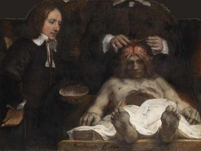 The Anatomy Lesson of Dr. Jan Deyman by Rembrandt van Rijn