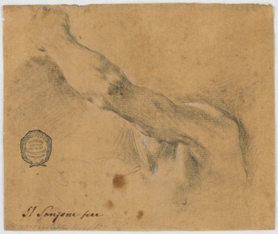 Study - The Left Arm and the Neighboring Parts of the Body of an Elderly Man by Unbekannt