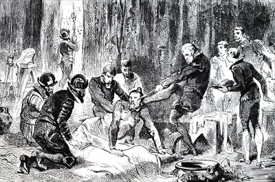 Ambroise Pare Removing a Lance from the Face of the Duc de Guise by Unbekannt