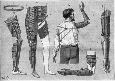 Modern apparatus for amputees. 1) artificial leg with belt, 2) apparatus for disarticulated thigh, 3 and 4 artificial arms invented and built by M.L Matthieu for the late Roger, 5) artificial arm with hand, thumb and index finger. in 