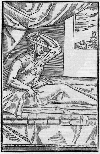 Nose surgery: Reconstructive surgery on the nose in De curtorum chirurgia per insitionem. Venice by Unknown artist
