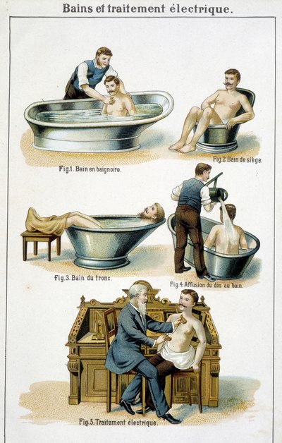 Baths and electric treatment: 1) Bathtub, 2) Seat bath, 3) Trunk bath, 4) Back to bath, 5) Electric treatment in 