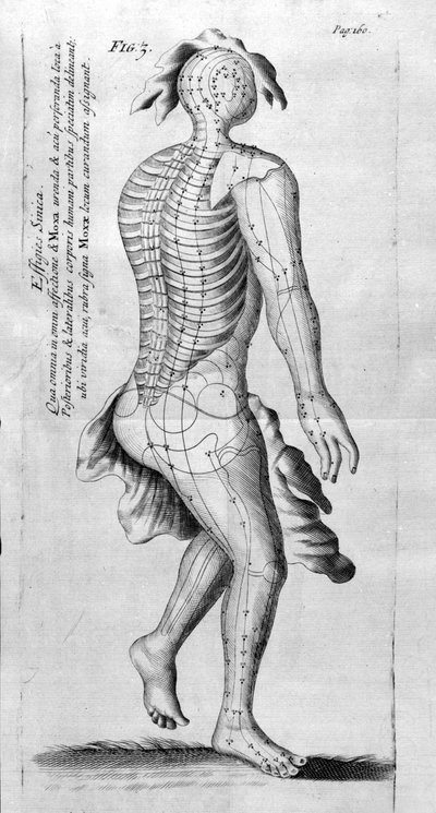 De Acupunctura by W.Ten Rhijne. London 1683. First Western text dealing with Acupuncture. by Unknown artist