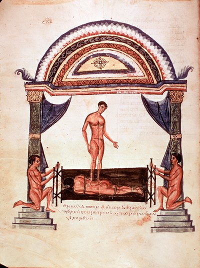 Medicine: Reduction of a Dislocated Spine - Patient is Fixed on a Wooden Board, One of the Therapists Stands on His Back by Unknown artist