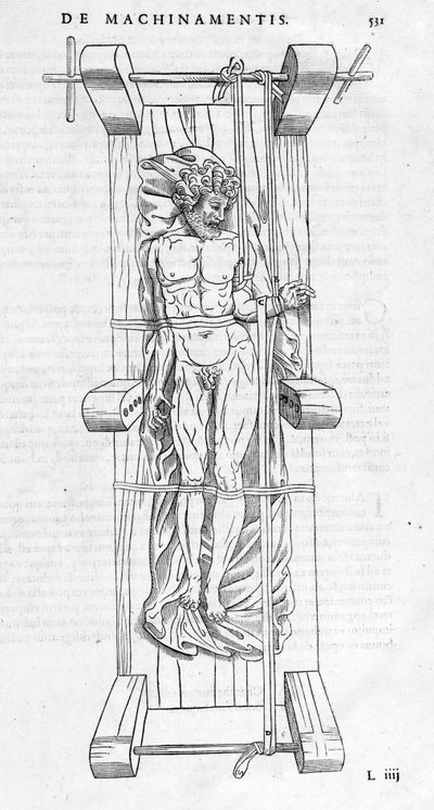 Reduction of fractures: a man is fixed on a stretcher, his broken arm is stretched between the two axes. Plate illustrated of 
