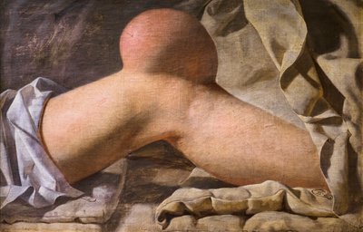 A Swelling in the Knee by Wilhelm Ferdinand Bendz