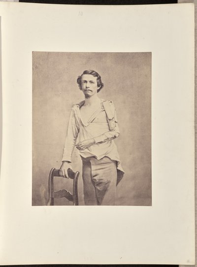 Successful Excision of the Head of the Left Humerus by William H. Bell