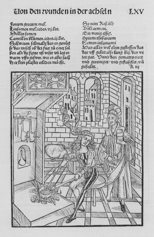The Book of Cirurgia by Hieronymus Brunschwig by (after) German School