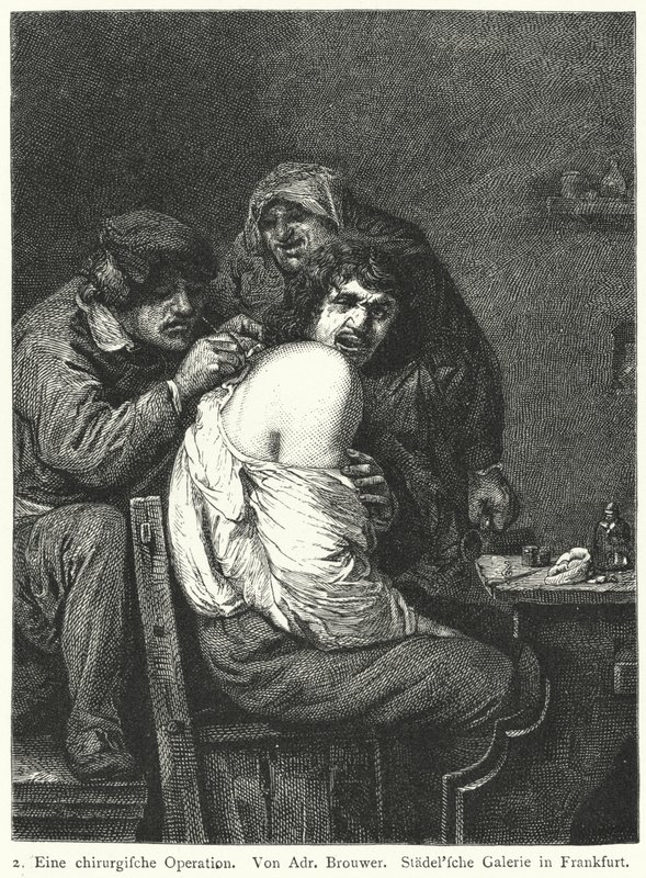 The Back Operation by Adriaen (after) Brouwer