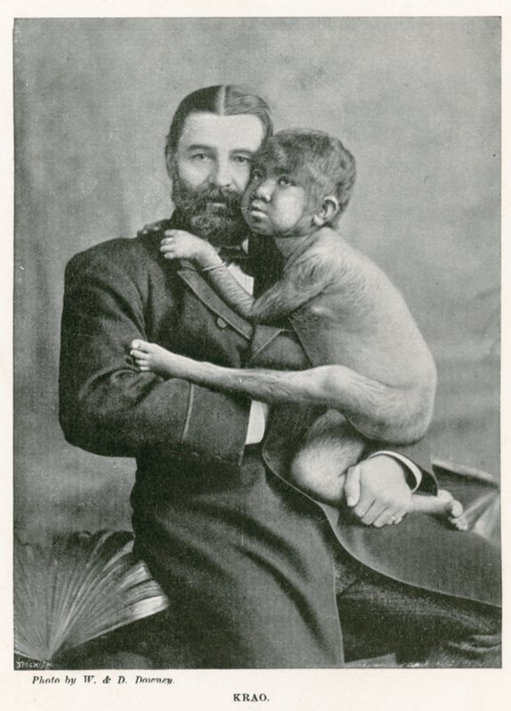 Krao, The Missing Link, Exhibited at the Aquarium, Westminster, London, in 1887 by English Photographer