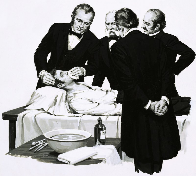 Dr Crawford Long renders a student unconscious before performing an operation by English School