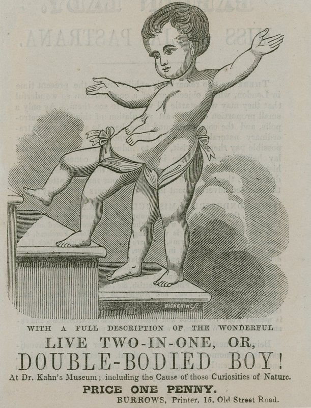 Live Two-in-One, or Double-Bodied Boy by English School