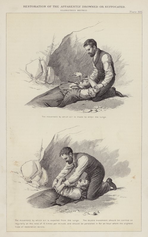 Restoration of the Apparently Drowned or Suffocated by English School
